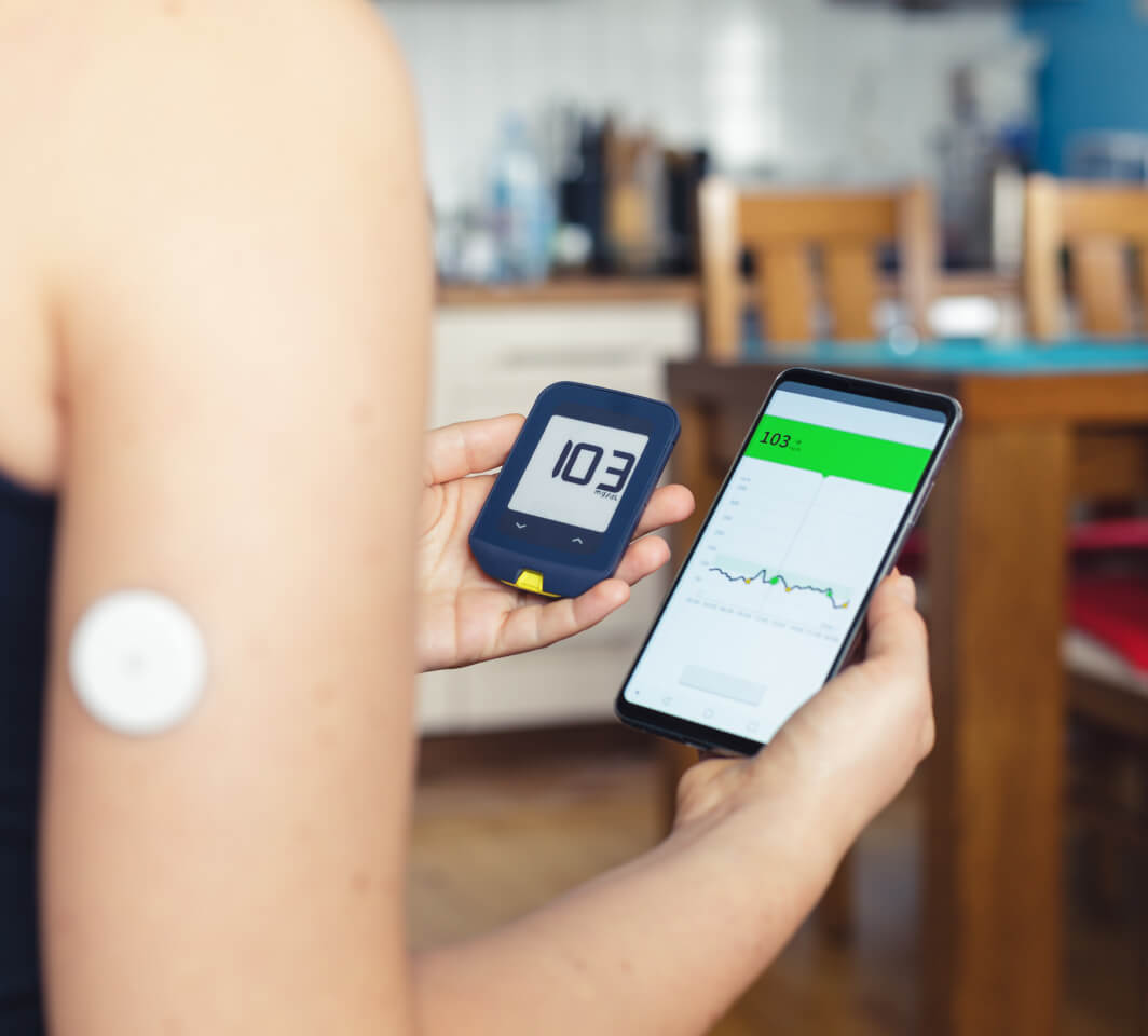 Importance of Continuous Glucose Monitoring (CGM) 