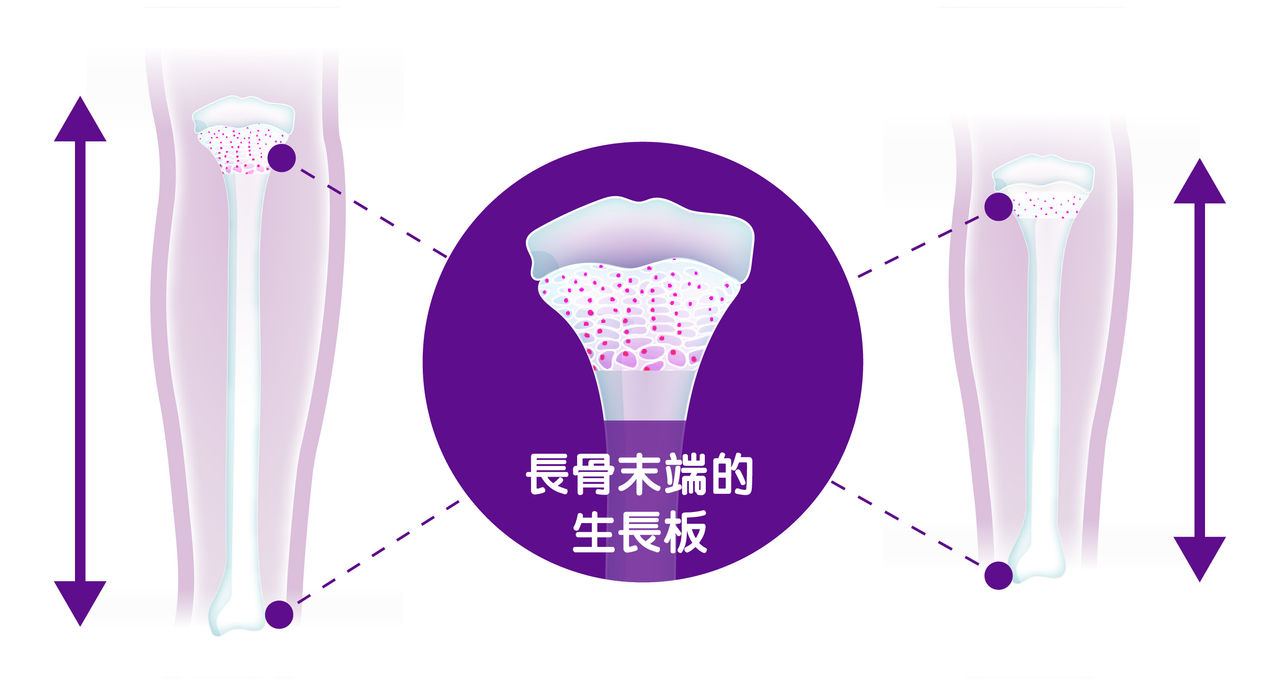 Abbott HK - Content Article Template_PediaSure Height