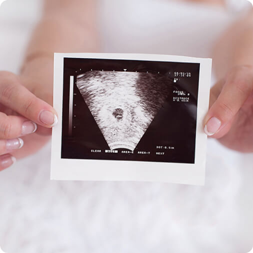 3 tháng đầu thai kỳ 