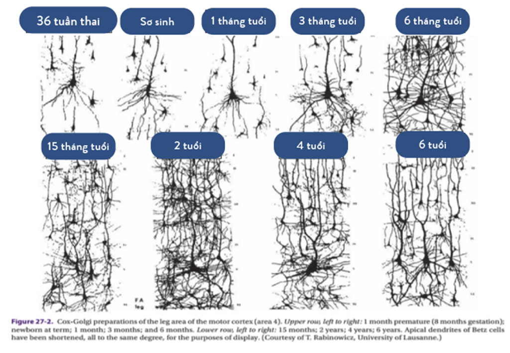 Hình. Sợi trục và sợi nhánh phát triển nhanh trong giai đoạn một năm đầu đời, cùng với đó là sự tăng trưởng về kích cỡ của não