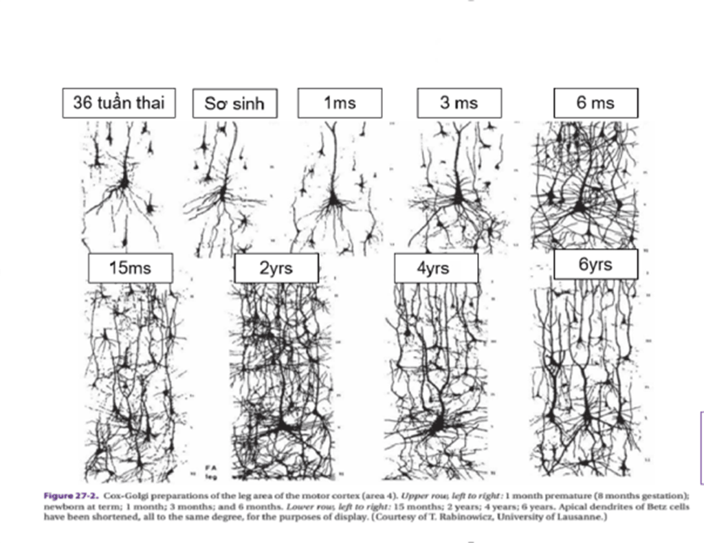 Hình: Sợi trục và sợi nhánh phát triển nhanh trong giai đoạn một năm đầu đời, cùng với đó là sự tăng trưởng về kích cỡ của não